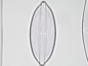 Microscope camera test shot