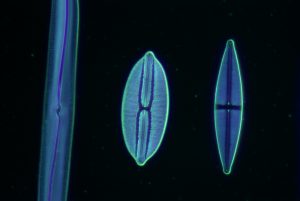 Diatoms darkfield x400