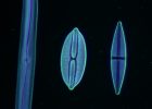 Darkfield diatoms x400