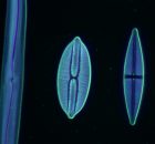 Darkfield diatoms x400