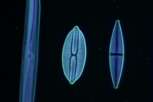 Darkfield diatoms x400