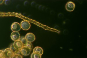 Trichia varia x 1000Cardioid condenser