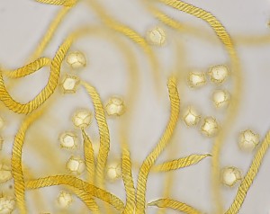 Trichia affinis spores - 12MP E3CMOS with 1000x Apo